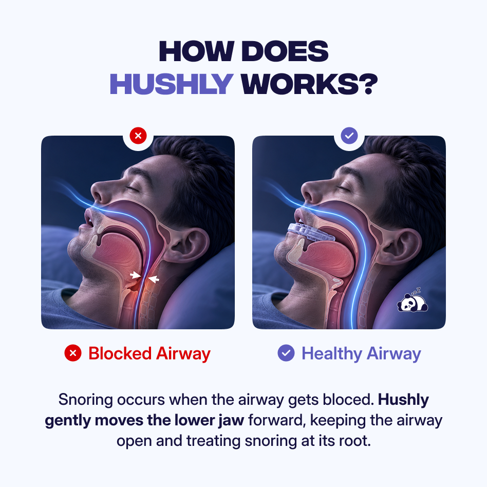 Anti-Snoring Mouthpiece